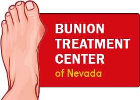 bunion center